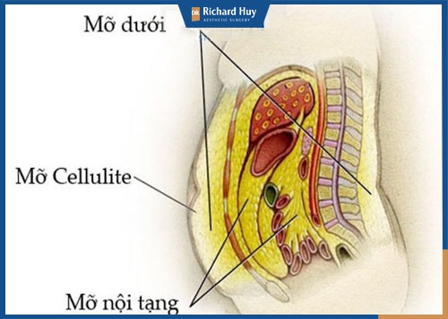  Mỡ tự thân dùng để cấy mỡ mắt thường lấy ở những vùng nhiều mỡ thừa như bụng, bắp tay, đùi