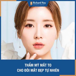 Thẩm mỹ mắt to - Cho đôi mắt sáng đẹp tự nhiên