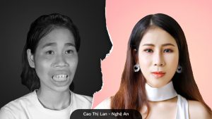 Cao Thị Lan và quá trình lột xác để chăm sóc tốt hơn cho mẹ 