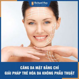 Căng da mặt bằng chỉ - giải pháp trẻ hóa không phẫu thuật