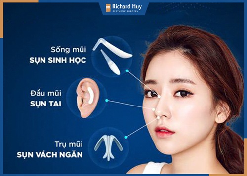 Các loại sụn tự thân được sử dụng trong nâng mũi cấu trúc