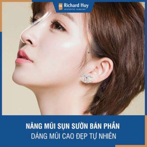 Nâng mũi sụn sườn bán phần - Dáng mũi cao đẹp tự nhiên