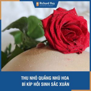 Thu nhỏ quầng nhũ hoa - Bí kíp hồi sinh sắc xuân