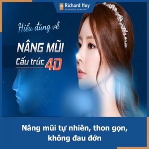 Cải thiện chiều cao chiếc mũi với phương pháp nâng mũi 4D Dr.Richard Huy