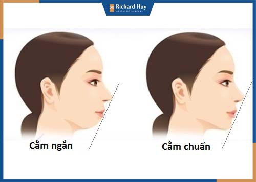 Gương mặt chuẩn cần có đỉnh mũi, chính giữa môi và cằm nằm trên đường thẳng cân đối để biểu lộ cảm xúc dễ dàng