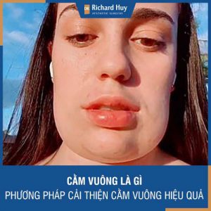 Cằm vuông là gì - Phương pháp cải thiện cằm vuông hiệu quả