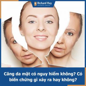 Căng da mặt có nguy hiểm không? Có gây ra các biến chứng gì không?