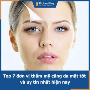 Hỏi đáp: Căng da mặt ở đâu tốt nhất, uy tín nhất hiện nay?