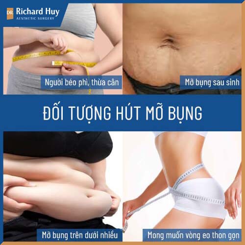 Đối tượng hút mỡ bụng