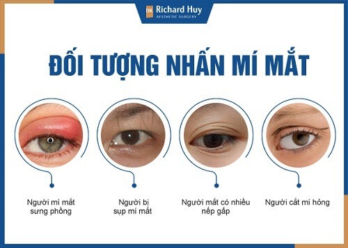 Những trường hợp phù hợp nhấn mí mắt 