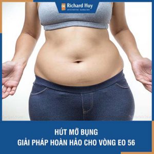 Hút mỡ bụng - Giải pháp hoàn hảo cho vòng eo 56