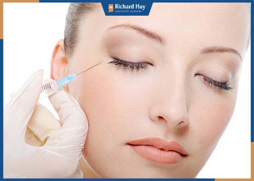 Kỹ thuật tiêm botox chỉ có hiệu quả trong vòng 3 đến 4 tháng 