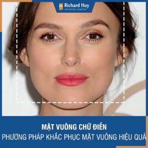 Mặt vuông chữ điền - Phương pháp khắc phục mặt vuông hiệu quả