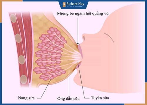 Khả năng cho con bú phụ thuộc vào mô tuyến sữa, không phụ thuộc vào lượng mỡ ở ngực 