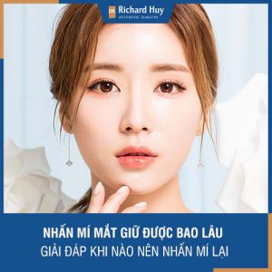 Nhấn mí mắt giữ được bao lâu - Dr. Richard Huy giải đáp khi nào nhấn mí lại