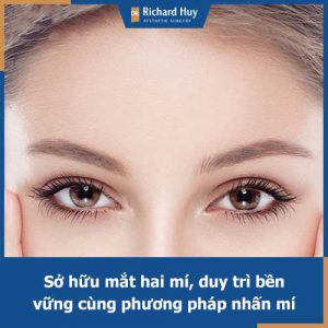 Tìm hiểu về phương pháp nhấn mí bằng chỉ cùng Dr. Richard Huy