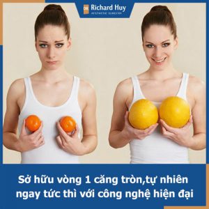 “Bỏ túi” cách tăng vòng 1 nhanh chóng, hiệu quả mà an toàn nhất