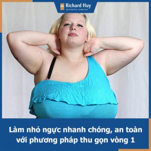 Bật mí các cách làm nhỏ ngực bẩm sinh, ngực sau sinh hiệu quả, an toàn