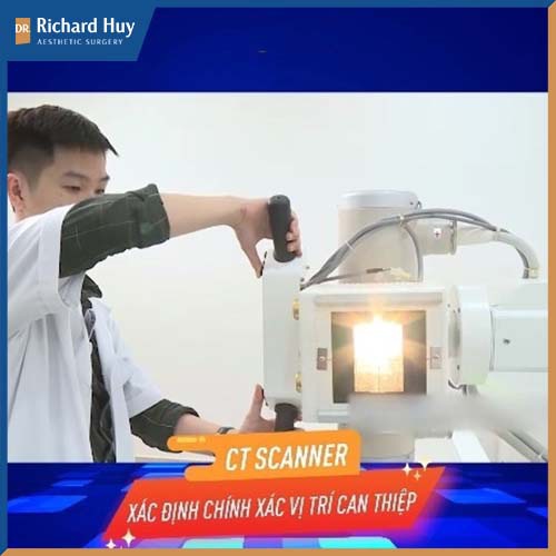 Công nghệ CT Scanner xác định chính xác vùng xương mặt, hạn chế xâm lấn 