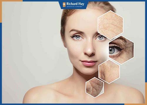 Đối tượng phù hợp với tiêm Botox