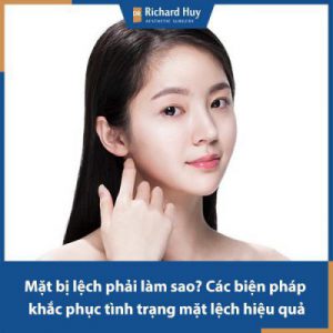 Mặt bị lệch thì phải làm sao? Các biện pháp khắc phục tình trạng mặt lệch hiệu quả