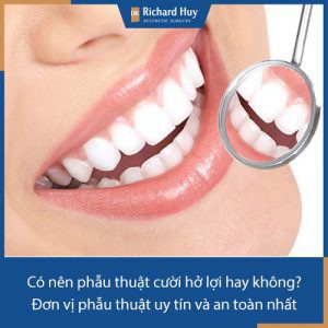 Có nên phẫu thuật cười hở lợi hay không? Đơn vị phẫu thuật uy tín và an toàn