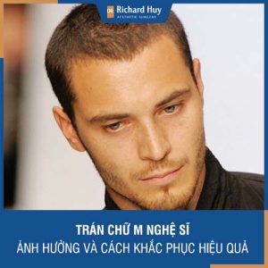 Trán chữ M “nghệ sĩ” - Tiết lộ bí mật phương pháp cải thiện trán chữ M hiệu quả.