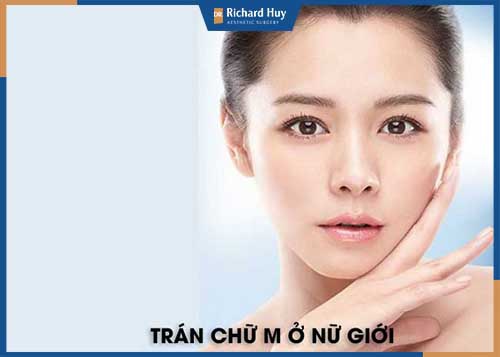 Con gái trán chữ M nổi bật với tính cách chín chắn và biết suy nghĩ trước sau.