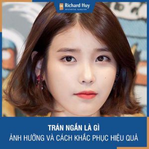 Trán ngắn là như thế nào? Trán ngắn có ảnh hưởng gì không? Cách khắc phục hiệu quả