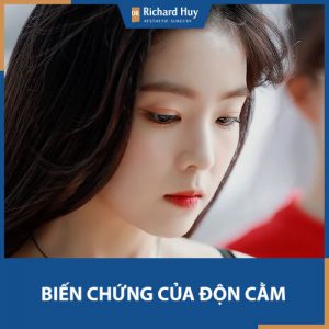 Top 5 biến chứng nguy hiểm nhất sau độn cằm chắc chắn bạn phải biết. 