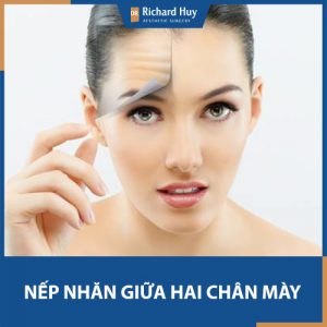 Nếp nhăn giữa hai chân mày tiết lộ gì về nhân tướng và cách hoá giải hiệu quả?