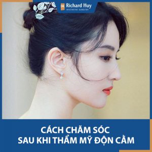 Những điều chắc chắn bạn phải biết khi chăm sóc độn cằm hồi phục vết thương