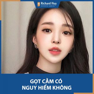 Những nguy hiểm chắc chắn bạn phải biết khi gọt cằm Vline 