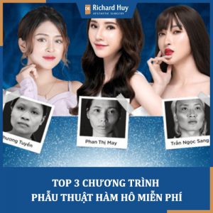 Điểm mặt các chương trình phẫu thuật hàm hô miễn phí - Thay đổi cuộc đời