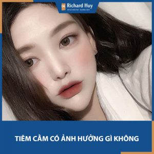 Tiêm cằm có ảnh hưởng gì không? Làm sao để hạn chế ảnh hưởng xấu?