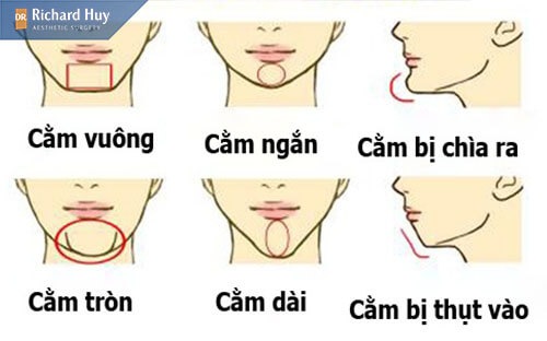 Các loại cằm phổ biện hiện nay