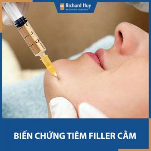 Biến chứng thường gặp khi tiêm Filler cằm và cách phòng tránh hiệu quả 