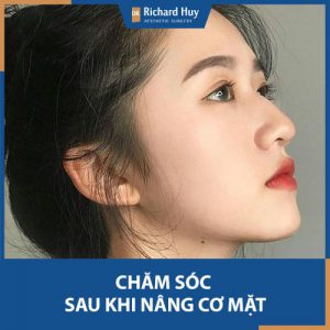 5 Lưu Ý Quan Trọng Sau Khi Điều Trị Nâng Cơ Mặt Chắc Chắn Bạn Phải Biết