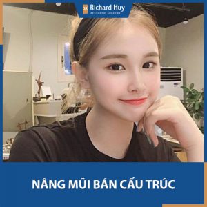 Nâng mũi bán cấu trúc - Tất tần tật mọi điều bạn cần biết