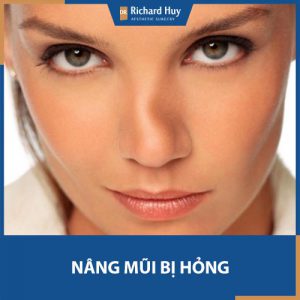 Nâng mũi bị hỏng phải làm thế nào để khắc phục nhanh chóng?