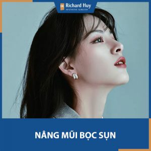 Nâng mũi bọc sụn - Mũi cao mềm mại không lo bóng đỏ