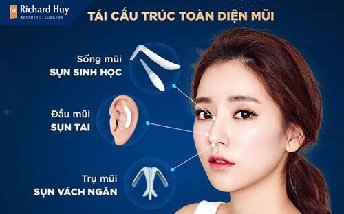 nâng mũi cấu chúc 4D