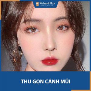 Thu gọn cánh mũi - GIẢI PHÁP SỐ 1 chữa khuyết điểm mũi to bè