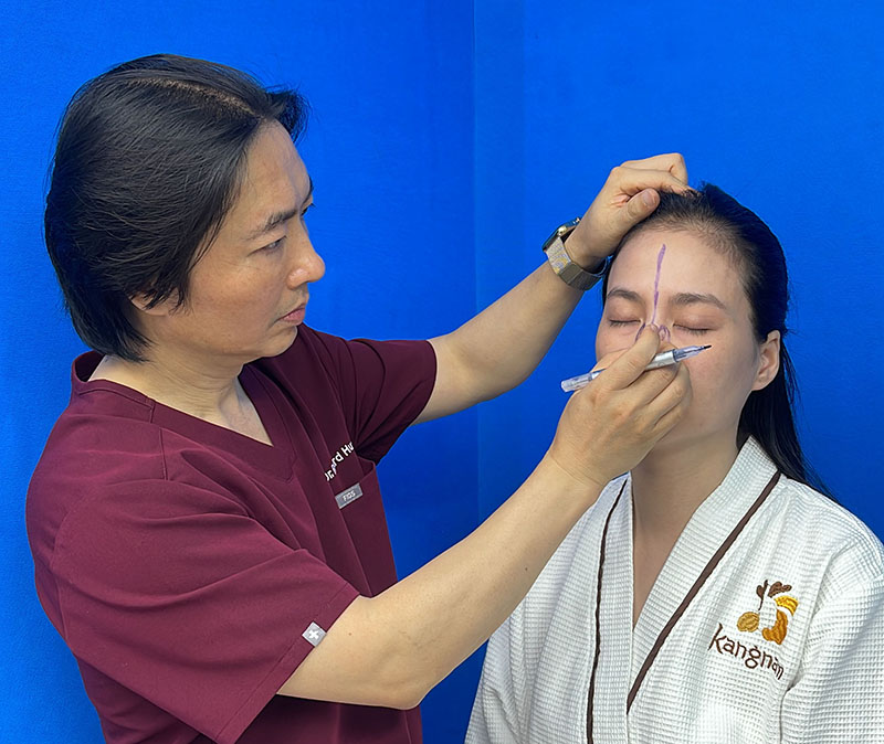 Richard Huy is measuring before planning to fix Thu Ha's damaged nose