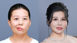 Dr. Richard Huy Reconstructs Faces and Corrects Facial Paralysis for Many Patients