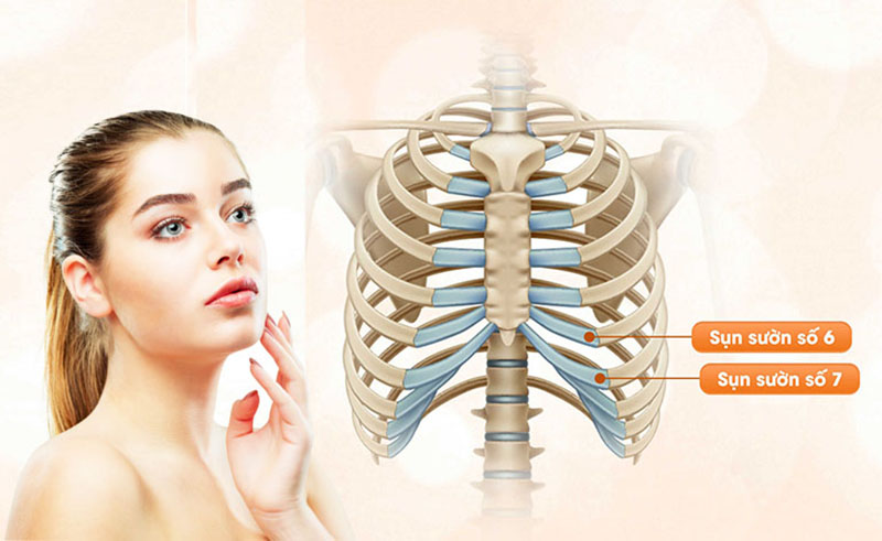 (Rib cartilage rhinoplasty uses autologous rib cartilage to reshape the nose.)