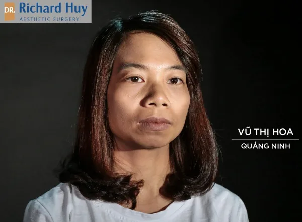 phẫu thuật thẩm mỹ