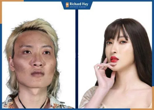 Thao tác kỹ thuật an toàn nhanh chóng, không gây đau đớn cho người bệnh 
