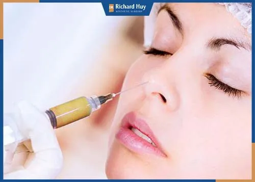 Tiến hành thực hiện tiêm cấy mỡ mặt 