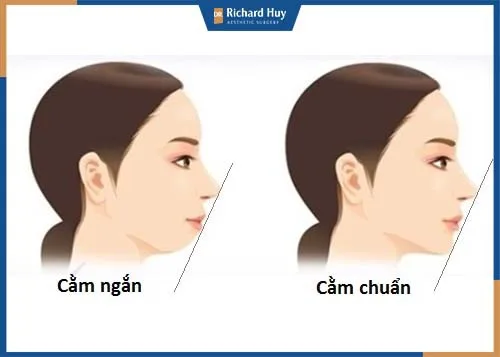 Gương mặt chuẩn cần có đỉnh mũi, chính giữa môi và cằm nằm trên đường thẳng cân đối để biểu lộ cảm xúc dễ dàng Gương mặt chuẩn cần có đỉnh mũi, chính giữa môi và cằm nằm trên đường thẳng cân đối để biểu lộ cảm xúc dễ dàng